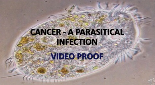 Cancer | Caused by Parasites | New Treatment Protocol&nbsp;Explained